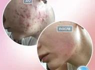 Клиника косметологии Skin Plastic Фото 5 на сайте Basmannyi.ru