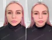 Клиника эстетической косметологии Beautyway clinic Фото 2 на сайте Basmannyi.ru