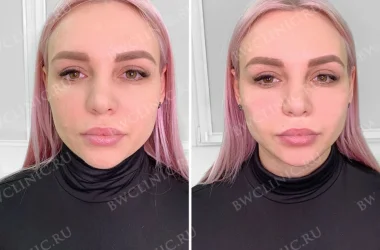 Клиника эстетической косметологии Beautyway clinic Фото 2 на сайте Basmannyi.ru
