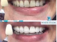 Студия отбеливания зубов White Studio Фото 2 на сайте Basmannyi.ru