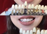 Студия косметического отбеливания зубов White&Smile Фото 1 на сайте Basmannyi.ru