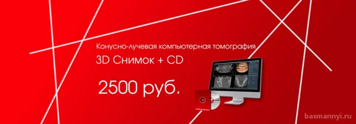 КТ 3D снимок + CD за 2500 руб